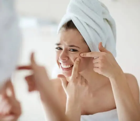 come eliminare i punti neri