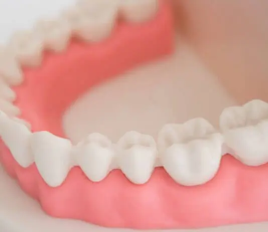 Denti gialli: bicarbonato denti