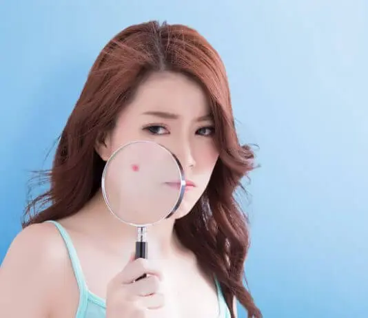 Brufoli Enormi e brufoli giganti: cosa Devi e Non Devi fare! brufoli enormi sottopelle