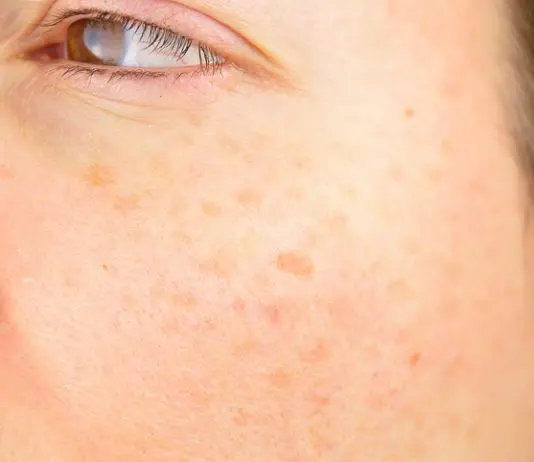 dermaskin