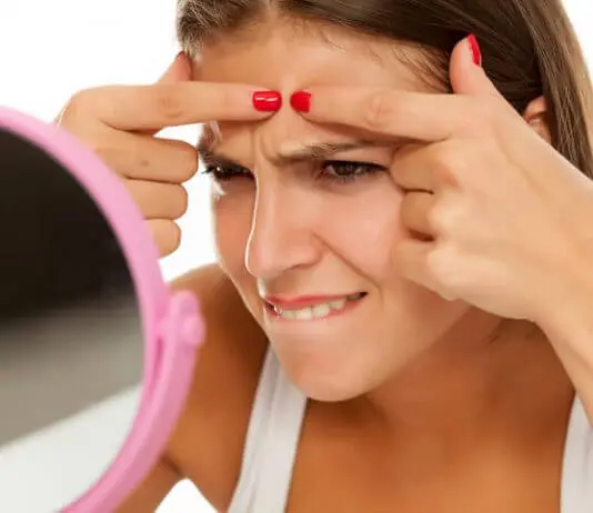 Schiacciare i brufoli: come si fa e a cosa devi fare attenzione! schiacciare i brufoli o no