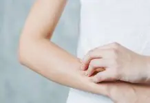 molluschi della pelle rimedi