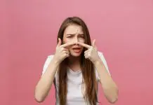 acne conglobata rimedi