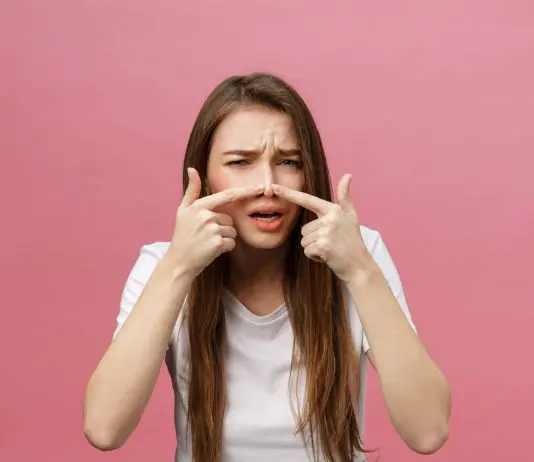 Acne Conglobata: Cos’è, Cause e Rimedi Efficaci! acne conglobata rimedi