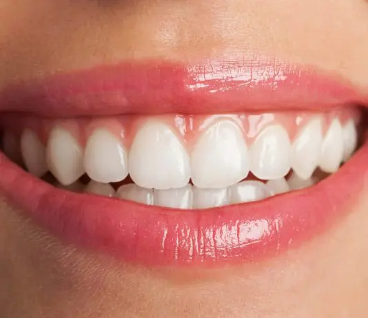 BioWhite: Addio Denti Gialli! biowhite recensioni