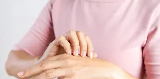 psoriasi mani