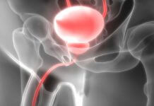 Prostata Infiammata: prostata sintomi