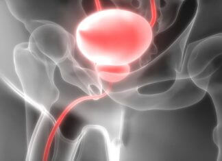 Prostata Infiammata: prostata sintomi