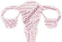 Ciste ovarica: cisti ovariche sintomi
