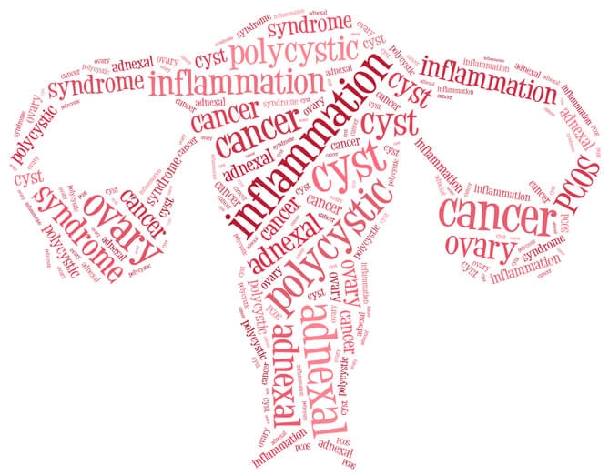 Ciste ovarica: cisti ovariche sintomi