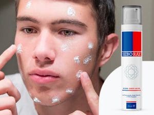 crema x acne giovanile crema x acne giovanile