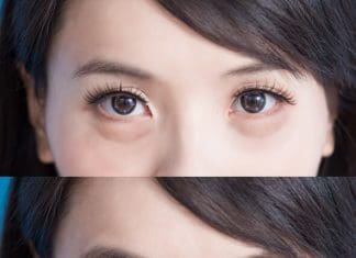 occhi gonfi al mattino cause