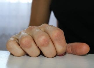 mani secchissime rimedi