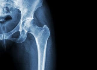 dolore inguine destro, mele all inguine destro