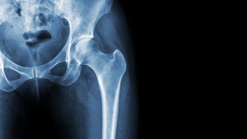 Dolore inguine destro o sinistro: Cause, Cure e Soluzioni ...