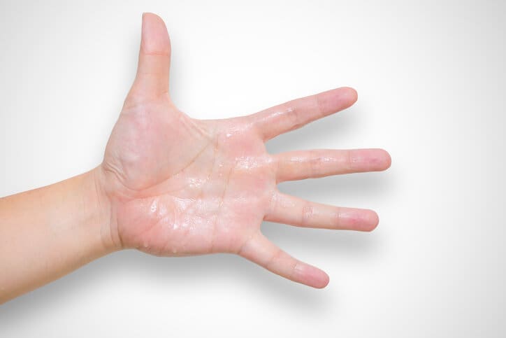 Mani Sudate: Cause, Accorgimenti e Rimedi Efficaci