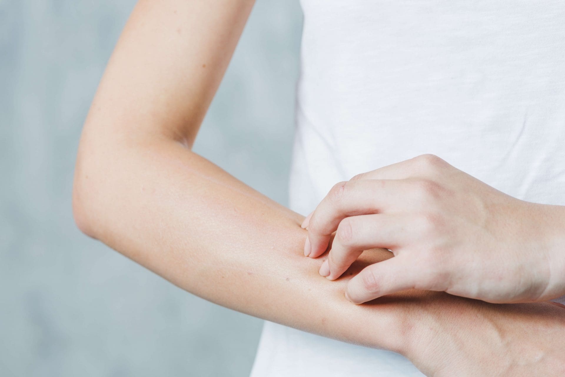 terapia mollusco contagioso bambini