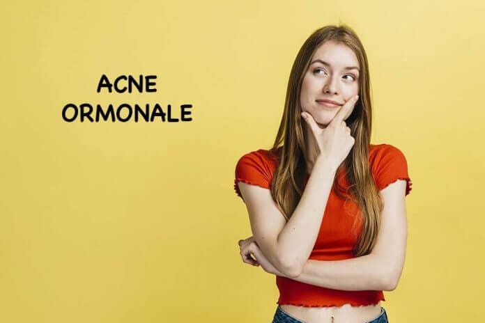 ACNE ORMONALE RIMEDI